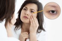 7 TIP xử lý mắt gấu trúc, quầng thâm ở vùng mắt